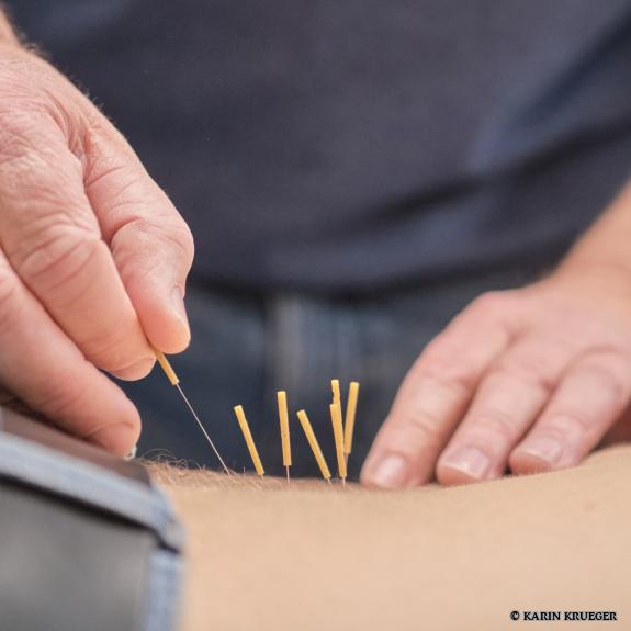 Arzt macht Akupunktur auf Rücken des Patienten